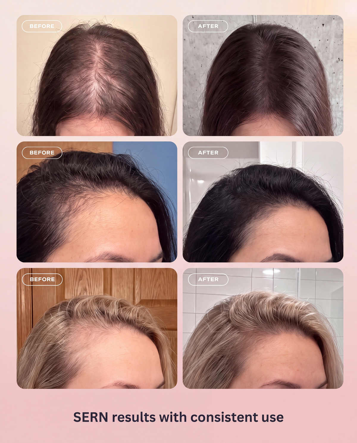 Peptide Hair Growth Elixir